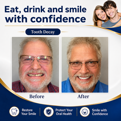 🔥Ends Today: 70% OFF!  🏆2026 Bestselling Product🦷 Fit for a Fresh Smile, Say Goodbye to Wearing Discomfort!🌎
