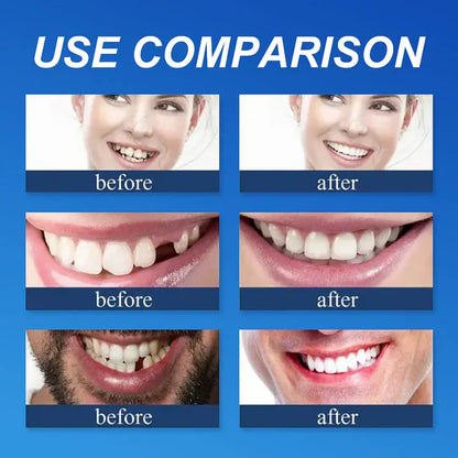 🏆Ends Today: 70% OFF!  🏆2026 Best selling Product🦷 Fit for a Fresh Smile, Say Goodbye to Wearing Discomfort!🌎
