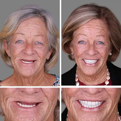 🏆Ends Today: 70% OFF!  🏆2026 Best selling Product🦷 Fit for a Fresh Smile, Say Goodbye to Wearing Discomfort!🌎