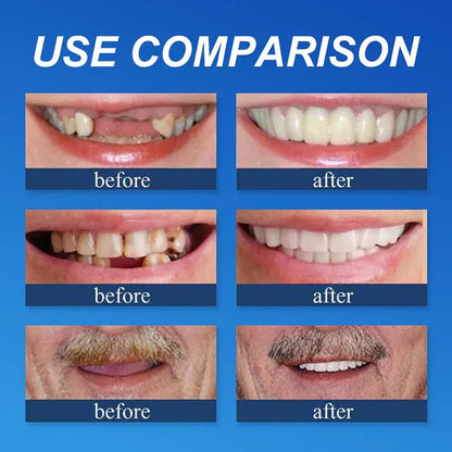 🏆Ends Today: 70% OFF!  🏆2026 Best selling Product🦷 Fit for a Fresh Smile, Say Goodbye to Wearing Discomfort!🌎